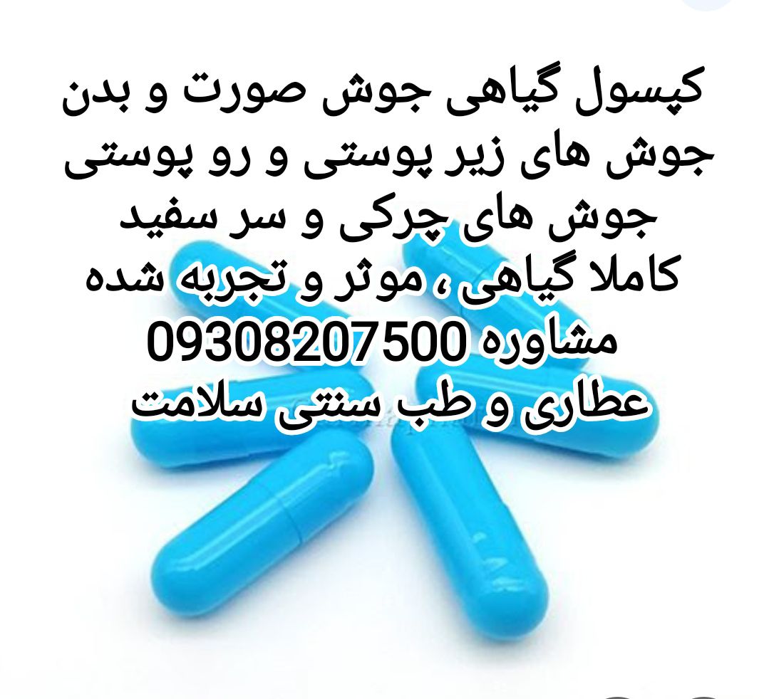 گپسول گیاهی جوش صورت و بدن 